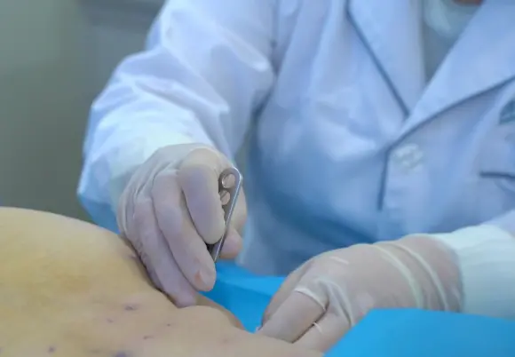 成都西部痛风风湿医院方氏风湿痹诊疗法被列入区级非物质文化遗产(图4) 成都西部痛风风湿医院方氏风湿痹诊疗法被列入区级非物质文化遗产(图4)